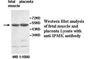 Image no. 1 for anti-Inositol Polyphosphate Multikinase (IPMK) antibody (ABIN1577290)