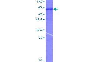 PPP3CC Protein (AA 1-512) (GST tag)