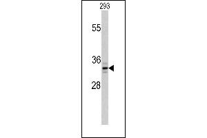 PPT1 Antikörper  (C-Term)