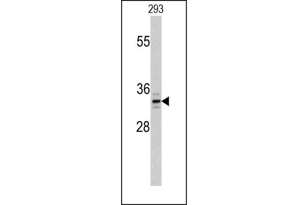 PPT1 Antikörper  (C-Term)