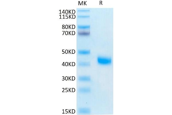 IL2 Receptor beta Protein (AA 27-239) (His-Avi Tag)