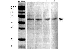 Western Blot analysis of Rat brain lysates showing detection of ASIC1 protein using Mouse Anti-ASIC1 Monoclonal Antibody, Clone S271-44 . (ASIC1 Antikörper  (AA 460-526) (Biotin))