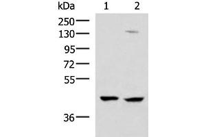 Western blot analysis of 293T and Jurkat cell lysates using MAGEC2 Polyclonal Antibody at dilution of 1:850 (MAGEC2 Antikörper)