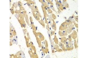 Immunohistochemistry of paraffin-embedded Mouse heart using HNMT Polyclonal Antibody at dilution of 1:100 (40x lens). (HNMT Antikörper)