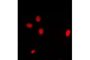 Immunofluorescent analysis of ING3 staining in Hela cells.