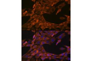Immunofluorescence analysis of NIH-3T3 cells using HE4/WFDC2 Rabbit mAb (ABIN1682653, ABIN3017632, ABIN3017633 and ABIN7101513) at dilution of 1:100 (40x lens). (WFDC2 Antikörper)