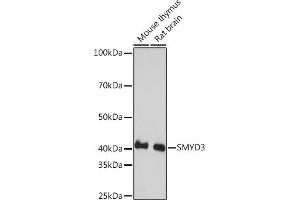 Western blot analysis of extracts of various cell lines, using SMYD3 Rabbit mAb (ABIN3015902, ABIN3015903, ABIN1680302 and ABIN1680303) at 1:1000 dilution. (SMYD3 Antikörper)
