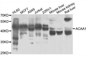 Western blot analysis of extracts of various cell lines, using ACAA1 antibody. (ACAA1 Antikörper  (AA 27-300))