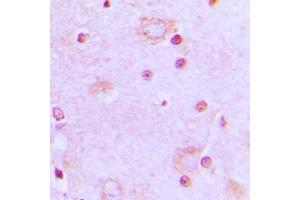 Immunohistochemical analysis of SRSF7 staining in human brain formalin fixed paraffin embedded tissue section. (SFRS7 Antikörper  (Center))