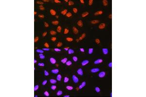 Immunofluorescence analysis of L929 cells using P4H Rabbit pAb (0538) at dilution of 1:100 (40x lens). (P4HA1 Antikörper  (AA 235-534))