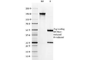 SDS-PAGE Analysis Purified Cytokeratin 6A (KRT6A) Mouse Monoclonal Antibody (KRT6A/2368).