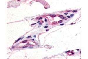 Immunohistochemical (Formalin/PFA-fixed paraffin-embedded sections) staining of human capillaries with GPR21 polyclonal antibody . (GPR21 Antikörper)