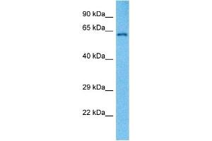 Western Blotting (WB) image for anti-Heterogeneous Nuclear Ribonucleoprotein L (HNRNPL) (N-Term) antibody (ABIN2778777)