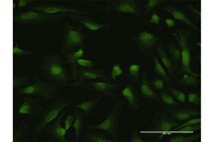 Immunofluorescence of purified MaxPab antibody to IKZF1 on HeLa cell. (IKZF1 Antikörper  (AA 1-477))
