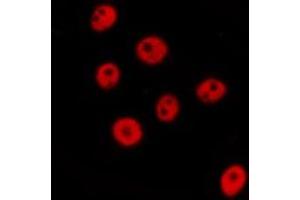 ABIN6277676 staining  NIH-3T3 cells by IF/ICC. (FLI1 Antikörper  (Internal Region))