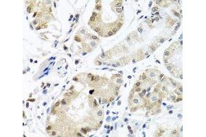 Immunohistochemistry of paraffin-embedded Human stomach using PCBP1 Polyclonal Antibody at dilution of 1:100 (40x lens). (PCBP1 Antikörper)