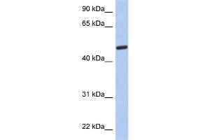 WB Suggested Anti-C2orf62 Antibody Titration: 0. (C2orf62 Antikörper  (N-Term))