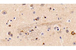 Immunohistochemistry (IHC) image for anti-Guanine Nucleotide Binding Protein (G Protein), beta Polypeptide 1-Like (GNB1L) (AA 69-247) antibody (ABIN7439600)