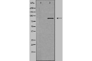 Western blot analysis of extracts from Jurkat cells using ZFYVE20 antibody.