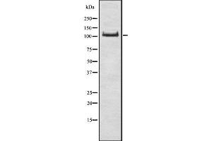 Western blot analysis of FYB using NIH-3T3 whole  lysates. (FYB Antikörper)