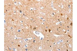 The image on the left is immunohistochemistry of paraffin-embedded Human brain tissue using ABIN7190855(GPR6 Antibody) at dilution 1/10, on the right is treated with synthetic peptide. (GPR6 Antikörper)
