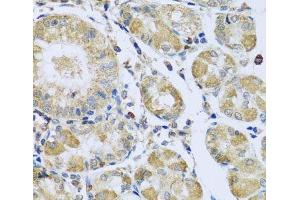 Immunohistochemistry of paraffin-embedded Human stomach using PMPCB Polyclonal Antibody at dilution of 1:100 (40x lens). (PMPCB Antikörper)