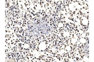IHC analysis of DBC-1/CCAR2 using anti-DBC-1/CCAR2 antibody (ABIN7602235).