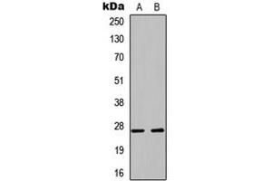 Western blot analysis of PLUNC expression in A549 (A), PC12 (B) whole cell lysates. (BPIFA1 Antikörper  (Center))