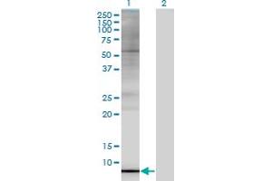 Western Blot analysis of ARL9 expression in transfected 293T cell line by ARL9 monoclonal antibody (M02A), clone 7A2. (ARL9 Antikörper  (AA 1-123))
