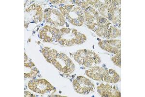 Immunohistochemistry of paraffin-embedded human stomach using VEPH1 antibody. (VEPH1 Antikörper  (AA 448-547))