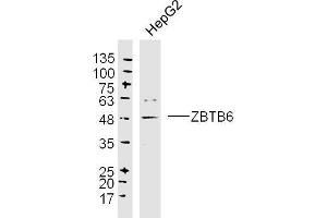 HepG2 lysates probed with ZBTB6 Polyclonal Antibody, Unconjugated  at 1:300 dilution and 4˚C overnight incubation.