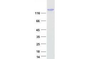 Validation with Western Blot (TCOF1 Protein (Transcript Variant 3) (Myc-DYKDDDDK Tag))