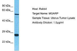 Host: Rabbit Target Name: MGARP Sample Tissue: Human Uterus Tumor Antibody Dilution: 1ug/ml
