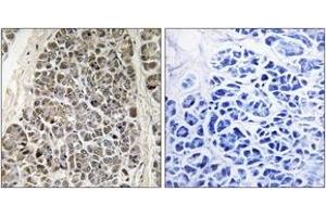 Immunohistochemistry analysis of paraffin-embedded human pancreas tissue, using MRPS21 Antibody. (MRPS21 Antikörper  (AA 38-87))