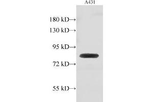 Western Blot analysis of A431 cell using GUSB Polyclonal Antibody at dilution of 1:500 (Glucuronidase beta Antikörper)