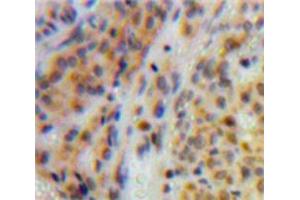 Used in DAB staining on fromalin fixed paraffin-embedded Ovary tissue (TOP2 Antikörper  (AA 923-1148))