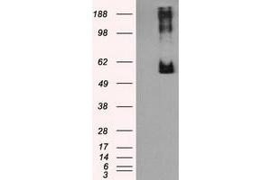 HEK293T cells were transfected with the pCMV6-ENTRY control (Left lane) or pCMV6-ENTRY LIPG (Right lane) cDNA for 48 hrs and lysed. (LIPG Antikörper)