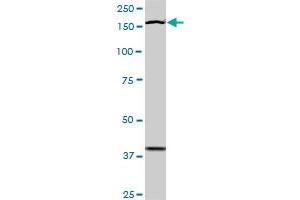 Western Blotting (WB) image for anti-TEK Tyrosine Kinase, Endothelial (TEK) (AA 66-185) antibody (ABIN793004) (TEK Antikörper  (AA 66-185))