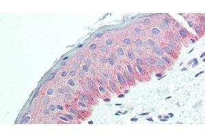Immunohistochemistry of paraffin-embedded Human Skin using NECTIN4 Polyclonal Antibody at dilution of 1:90.