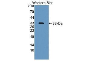 Western Blotting (WB) image for anti-N-Acetyl alpha-D-Glucosaminidase (AA 485-743) antibody (ABIN1869393) (N-Acetyl alpha-D-Glucosaminidase (AA 485-743) Antikörper)