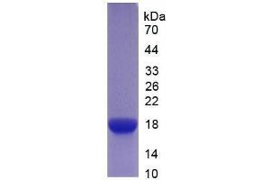 SDS-PAGE (SDS) image for Interleukin 6 Receptor (IL6R) (AA 52-204) (Active) protein (His tag) (ABIN6239822)