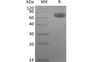 Western Blotting (WB) image for TNF Receptor II/TNF RII/TNFRSF1B/CD120b protein (Fc Tag) (ABIN7321038) (TNF Receptor II/TNF RII/TNFRSF1B/CD120b protein (Fc Tag))