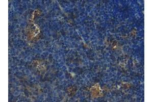 DAB staining on IHC-P; Samples: Mouse Lymph node Tissue (S100 Protein (S100) (AA 2-94) Antikörper)