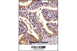 PHLDA2 Antibody immunohistochemistry analysis in formalin fixed and paraffin embedded human prostate tissue followed by peroxidase conjugation of the secondary antibody and DAB staining. (PHLDA2 Antikörper  (C-Term))