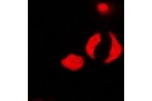 Immunofluorescent analysis of PP1 beta staining in U2OS cells.