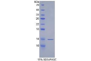 SDS-PAGE (SDS) image for Pro-Platelet Basic Protein (Chemokine (C-X-C Motif) Ligand 7) (PPBP) (AA 59-128) protein (His tag) (ABIN1078968)