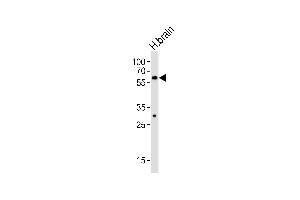 Western blot analysis of lysate from human brain tissue lysate, using ZN Antibody (C-term) (ABIN6242707 and ABIN6577591). (ZNF610 Antikörper  (C-Term))