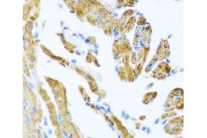 Immunohistochemistry of paraffin-embedded Mouse heart using COL9A3 Polyclonal Antibody at dilution of 1:100 (40x lens). (COL9A3 Antikörper)