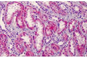 Immunohistochemistry (Formalin-fixed Paraffin-embedded Sections) (IHC (fp)) image for anti-Hepatocyte Growth Factor (Hepapoietin A, Scatter Factor) (HGF) (AA 521-554) antibody (ABIN2450637)