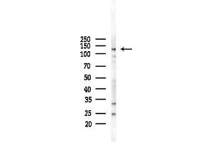 anti-Caspase Recruitment Domain Family, Member 6 (CARD6) (N-Term) antibody